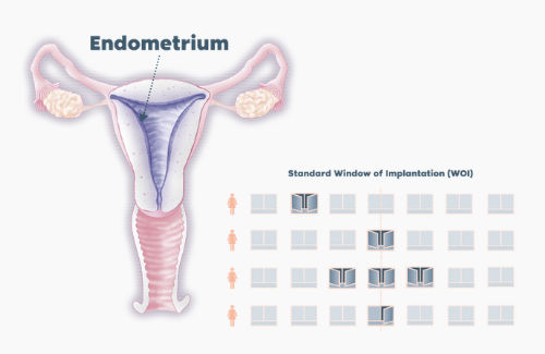 Endometrium fruchtbares Fenster