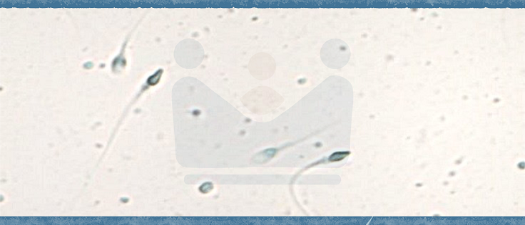 Sperma Spermiogramm Düsseldorf Prinzenallee.png