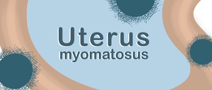 Uterus myomatosus und Kinderwunsch